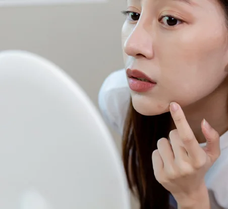 Is an Acne Vaccine the Future of Clear Skin? 2 Experts and Our Readers Weigh In