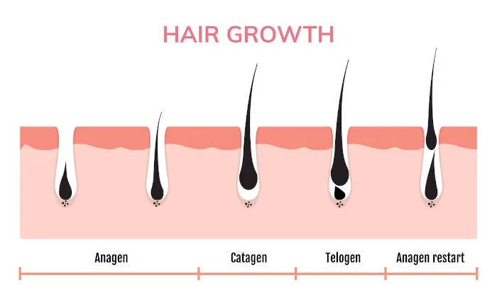 Illustration of the four stages of hair growth: Anagen, Catagen, Telogen, and Anagen restart | Shine Dermatology