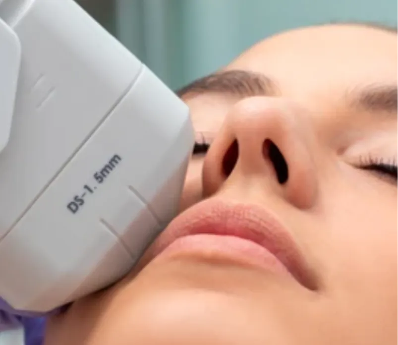 Woman lying with eyes closed while receiving an Ultherapy treatment | Shine Dermatology