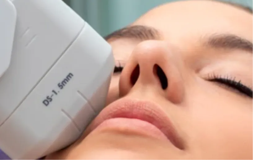 Woman lying with eyes closed while receiving an Ultherapy treatment | Shine Dermatology